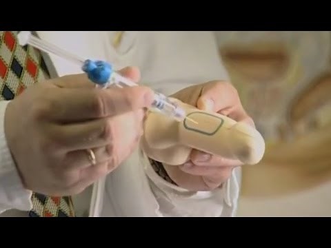 Erektionsstörung - Ursachen und Therapie