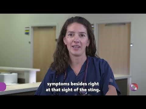 How do you treat a bee sting?