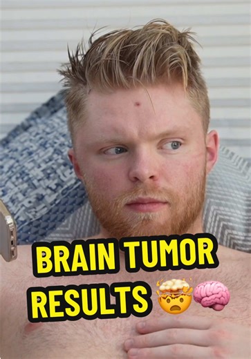 When I found out my brain tumor results 🧠🤯 #tjass #braintumor #brainsurgery #surgery #tumor