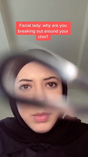 You guys were mad at my last story so here’s a part 2! #truestory | chin acne