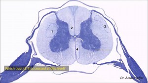 Which tract is crossed at this level? Check this video out to confirm your answer. #MEDNEURO #NEURO #NEUROLOGY For similar videos and more questions about the spinal cord, check this video out on YouTube https://www.youtube.com/watch?v=Kb-PHiiZtCw&t=4s Subscribe to the channel to get updates. | Human Anatomy Education | Facebook