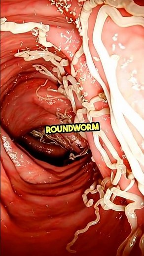 how to prevent roundworm infection? #roundworm #worms