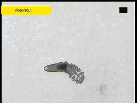 Demodex killed by tea tree oil