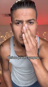 112K views · 1.1K reactions | Before and After Plastic Surgery… #fyp #foryoupage #funny #foryouシ | Francisco Barbosa | Facebook