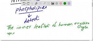 SOLVED:Ninhydrin reacts specifically with primary amines to form a purplish-blue product. A thin-layer chromatogram of rat liver phospholipids is sprayed with ninhydrin, and the color is allowed to develop. Which phospholipids can be detected in this way?
