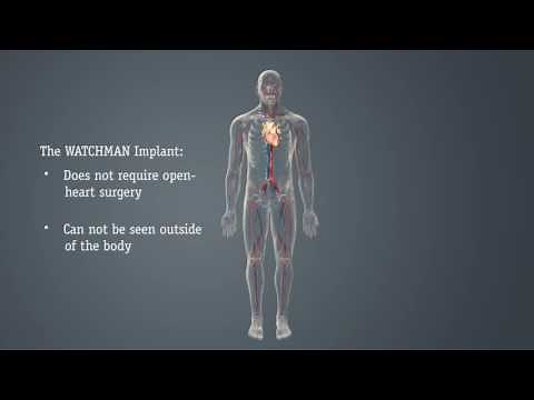 Cardiovascular WATCHMAN™ to Reduce AFib Stroke Risk