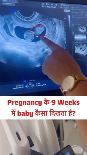 Dr Sonal Chouksey on Instagram: "9वें हफ्ते में आपका बेबी कैसा दिखता है? 🤰✨ देखिए baby का development और जानें early pregnancy के signs! 💛 #pregnancy #momtobe #pregnancyjourney #9weeks #instagood ( pregnancy, ninth week pregnancy, baby development, first trimester, early pregnancy, baby in womb, pregnancy care, fetal growth, pregnancy tips, expecting mother, prenatal care, pregnancy awareness )"