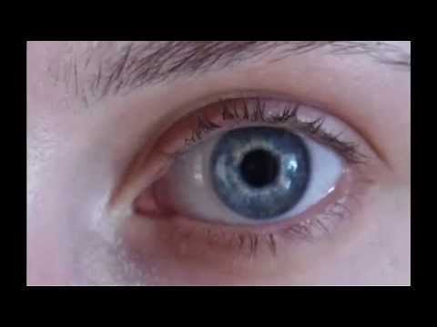 Freshlook on blue eyes