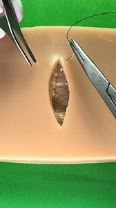 9M views · 29K reactions | Simple interrupted stitch | Dermhacks | Facebook