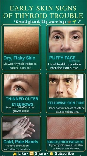 “Early Skin Signs of Thyroid Trouble 🦋🌿 (Don’t Ignore These Warnings)”