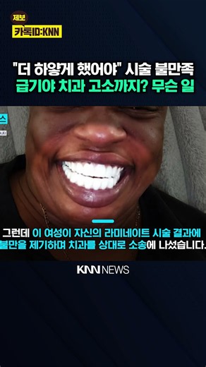"Not bright at all!" See the 'blindingly' white teeth of the woman who sued her dentist / KNN