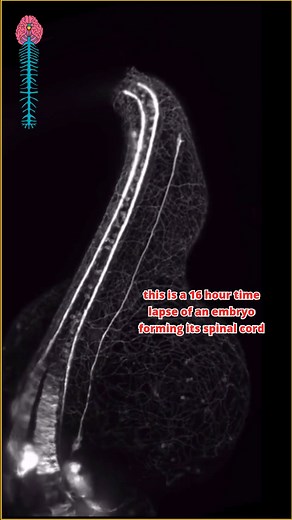 1M views · 15K reactions | From cells to spine in just 16 hours ⏳✨...