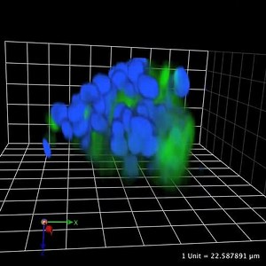File:Inhibition-of-cathepsin-B-activity-attenuates-extracellular-matrix-degradation-and-inflammatory-bcr3058-S4.ogv - Wikimedia Commons
