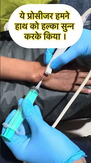 Ganglion cyst treatment- without CUT