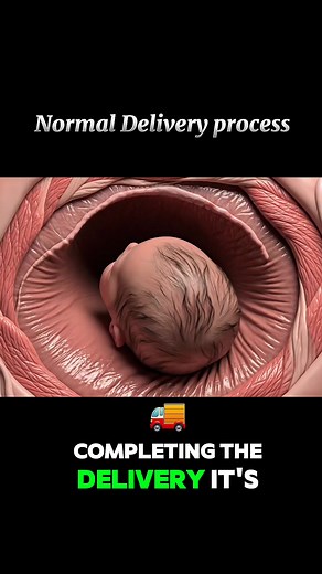 200K views · 2.8K reactions | Normal delivery process without operation #pregnancy #foryou | Dr. Daleep Kumar Italy | Facebook