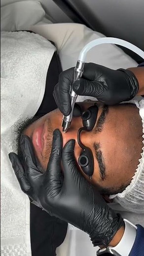 Deep Cleanse & Glow 🌸 See How This Microdermabrasion Machine Works!
