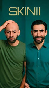 @skin.111 and @gjuneja47 I’m back to normal! Thanks habibis | BaselGazi