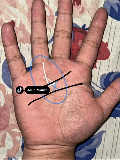 Understanding Rich and Millionaire Signs in Palmistry