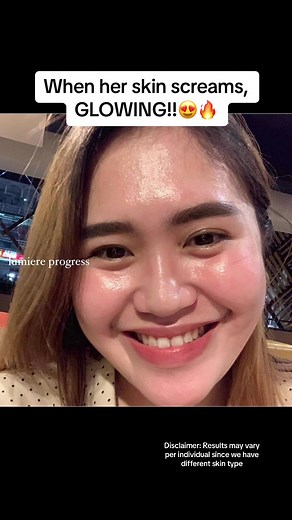 Glowing Skin with Lumiere Facial Set - Acne Treatment Review