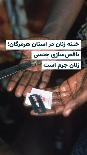 🎥 بر اساس یافته‌های یک پژوهش میدانی در هرمزگان، ختنه یا ناقص‌سازی جنسی زنان در بسیاری از خانواده‌ها همچنان در چارچوب سنت‌ها انجام می‌شود. بر اساس این پژوهش که در قالب یک مقاله در آخرین شماره فصل‌نامه «مسائل اجتماعی ایران» دانشگاه خوارزمی منتشر شده است در هرمزگان، ناقص‌سازی جنسی زنان در بسیاری از خانواده‌ها نه به‌عنوان ضرورتی پزشکی، بلکه در چارچوب سنت‌ها، فشارهای خویشاوندی و برداشت‌های دینی بازتولید می‌شود؛ چرخه‌ای که پیامدهای جسمی و روانی آن تا سال‌ها در زندگی زنان باقی می‌ماند. در این مقاله، ا
