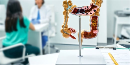 Colon Cancer Is Being Caught Earlier, Research Confirms—When to Start Getting Screened — Best Life