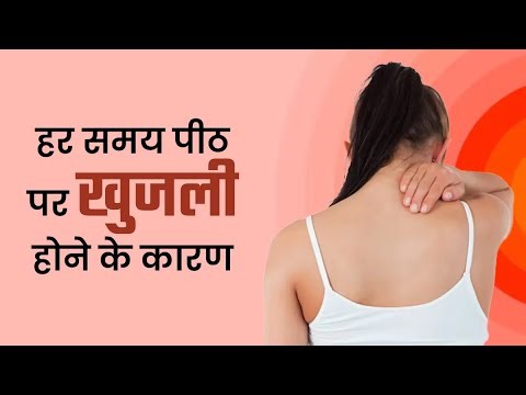 Is it normal to feel itchy on the back all the time? Causes of itching at back every time