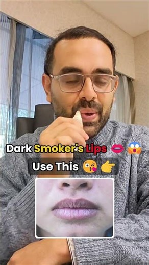 Dark Smokers Lips 💋 😪 #darklips #lipbalm #lipcare