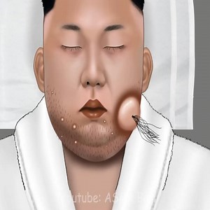 Caroço enorme no KIM JONG UN #gameplay #japao #correias | Dvitor