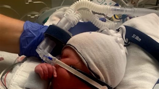 Seattle study gives NICU parents genetic answers in days, not years