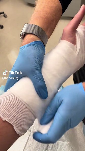 Quick Cast Application Tutorial | Orthopedic Surgeon