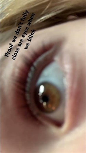 JUMP SCARE🚨‼️ proof we don’t fully close are eyes when we blink