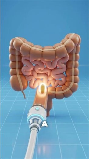 You Can Actually Donate Your Poop 😳💩 #shorts #explore