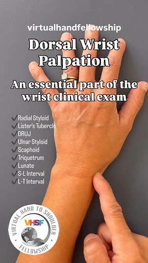 Dorsal Wrist Palpation: Clinical Exam Essentials Following up on our recent post on volar localization of the capitate and lunate, this video walks through the key dorsal wrist landmarks—an essential part of the wrist clinical exam. This content was developed ahead of two upcoming programs, each serving different clinical goals: 🔹 Intro to Hand Therapy (begins August 14) – ideal for clinicians who are exploring hand therapy or looking to broaden their skills to treat 10 common hand pathologies.