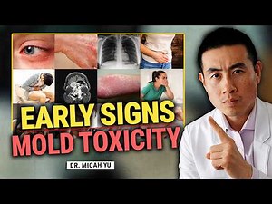 Early Warning Signs of Mold Toxicity