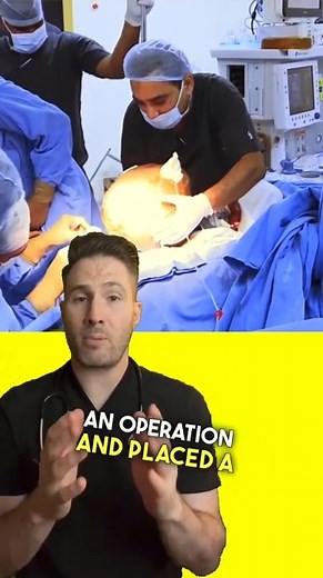 Severe hydrocephalus causing the worlds largest head. #hydrocephalus #pediatrics #neurosurgery #erdoctor #drjoe | Doctor Joe