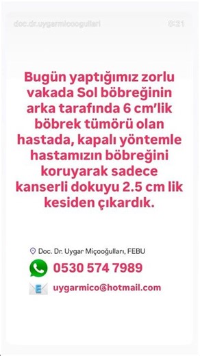 6 cm Kidney Tumor Removed with Only 2.5 cm Incision | Kidney-Sparing Minimally Invasive Surgery