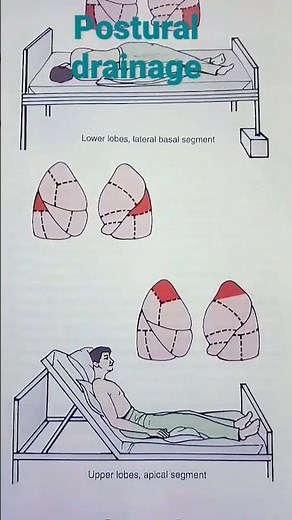 postural drainage positions& the areas of lungs drained by each position