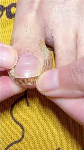 Fix Overlapping Toes Instantly 👣 | Easy Toe Separator Hack for Pain Relief 💡