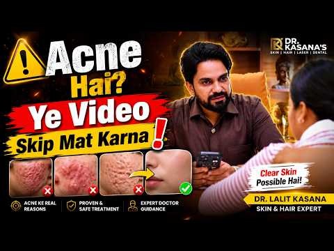 Struggling with Acne? Don't Skip This Video! | Acne Treatment Explained by Dr. Lalit Kasana