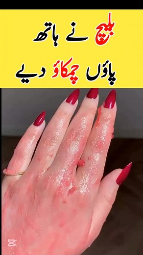 313K views · 5.2K reactions | Instant Glow Bleach #InstantWhitening #GlowingSkin #SkinWhitening #FaceAndFeetGlow #WhiteningBleach #FairAndGlowingSkin #NaturalGlow #BeautyCareTips #SkinCareRoutine #InstantGlowUp #WhiteningCream #BleachAtHome #HomemadeBleach #GlowSkinCare #SkinCareGoals | Simple Beauty Tips | Facebook