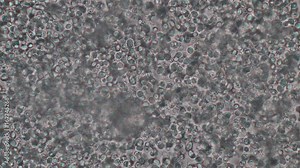 Budding yeast cell under the microscope.