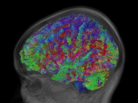 Single-Shell 3-Tissue CSD (SS3T-CSD) tractography