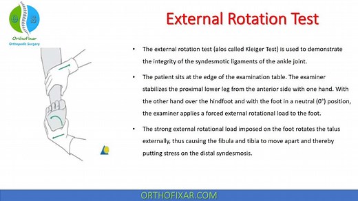 Ankle External Rotation Test Explained Easily | OrthoFixar