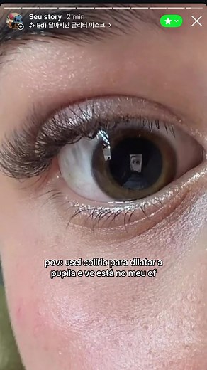 Dilatação de Pupilas com Colírio e Máscara Glitter