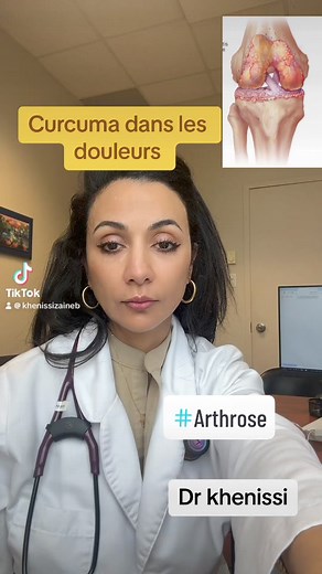 29K views · 662 reactions | #viralreelsfb #PainRelief #foryoupage #arthrose #kneepain | Dre Khenissi Zaineb | Facebook