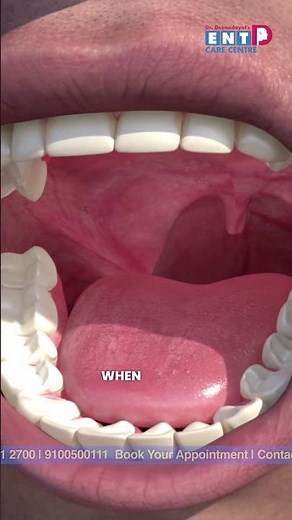 Why Do Tonsils Cause Repeated Pain? #decc #entcare #nasalblockage #tonsilpains #shorts