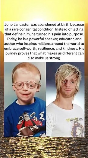 “Abandoned at Birth, Embraced by the World”❤️❤️❤️