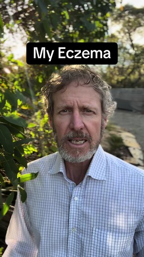 Steve (Eczema) Gee on TikTok