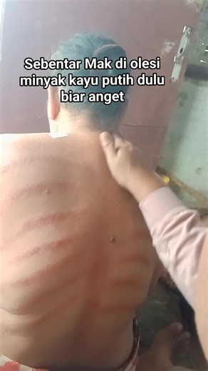 Kerokan Mak e #pijat #kerokan #massage #fyp | R.official