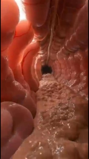 3D Digestive Tract Animation | Inside the Human Colon in Ultra Realistic Detail. #short #viralpost2025シ #reelsviralシ #shortsreels #shortsreels #reelsviralシfb #reelsfbシ #facebookreelsviral #reelsfypシ #viralreelschallenge #reelsvideo #body3dart #trend #trendingnow #funny #AI #animation #3danimation | Body 3D Art
